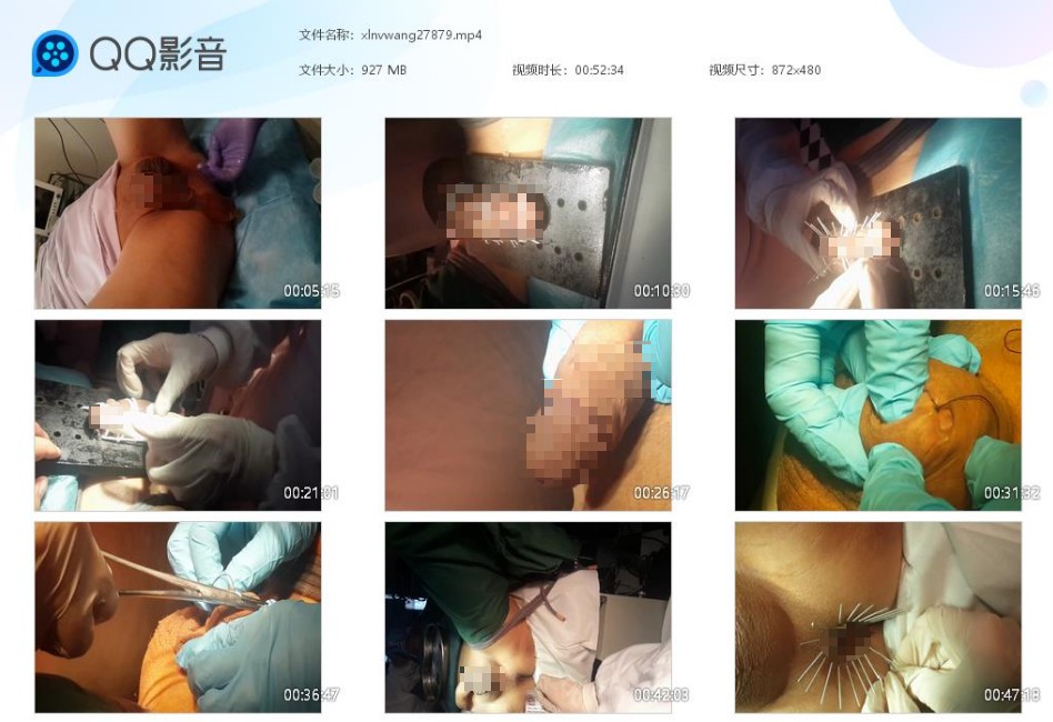 女王医疗调教贱奴_阄割导尿穿刺手术线缝视频下载-字母网社区