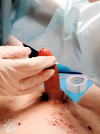 娇柔影视_索s医疗调教穿刺JB狗蛋电动刺激视频下载-字母网社区