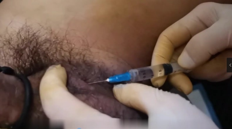 素人女S_医疗虐马眼针刺蛋皮假阳具捅菊花到喷尿视频下载-字母网社区